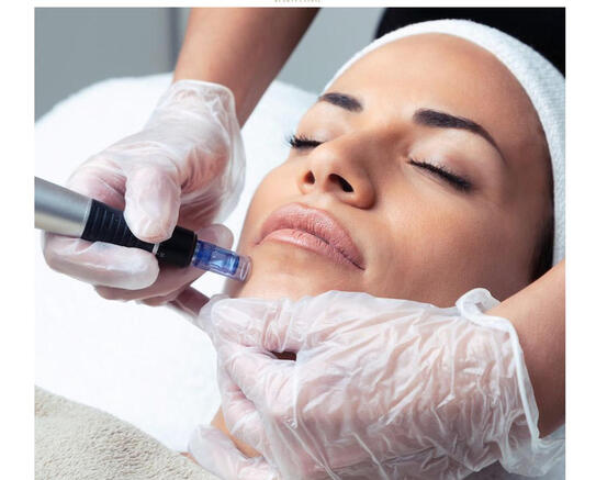 Treatment of the week - Microneedling - 15% off this week!